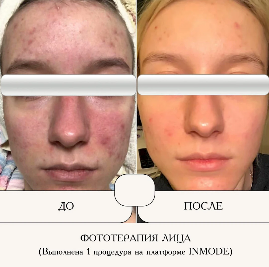 Результат процедуры, кадр 1