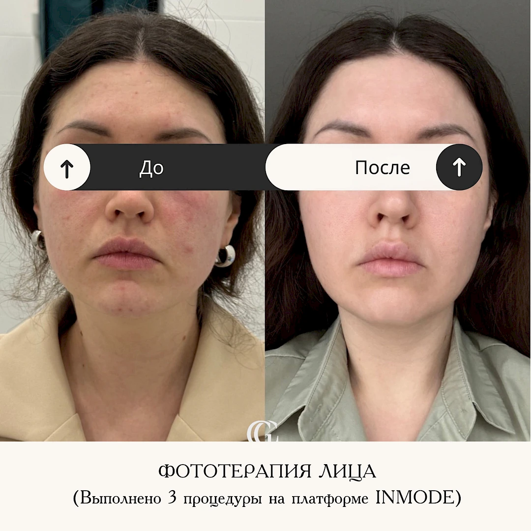 Результат процедуры, кадр 3