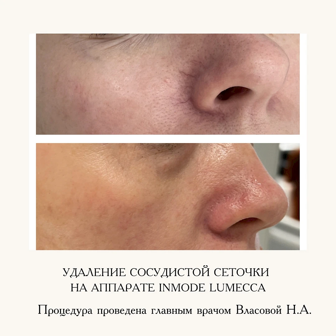 Результат процедуры, кадр 5