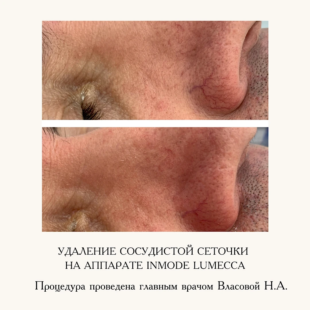 Результат процедуры, кадр 6