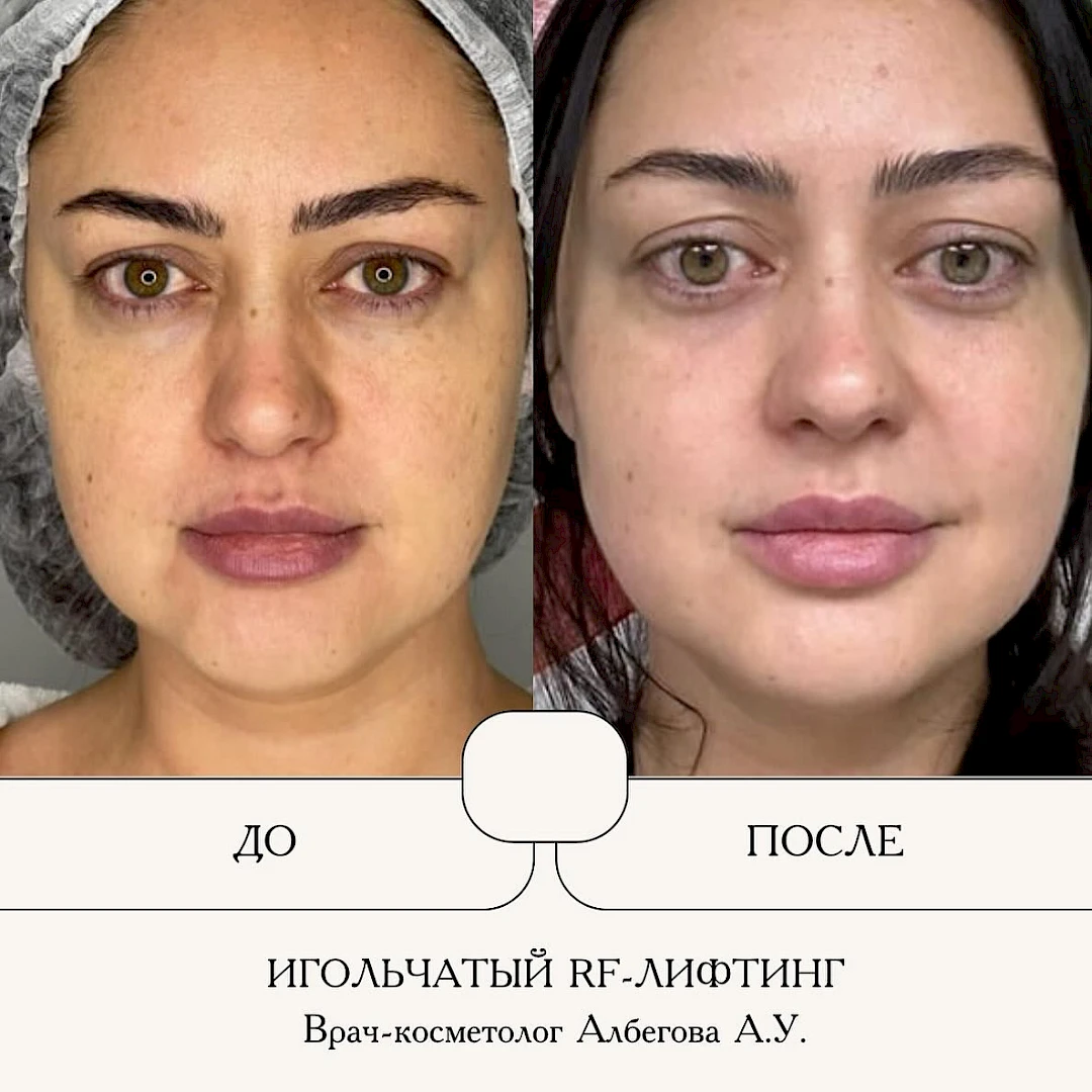 Результат процедуры, кадр 7