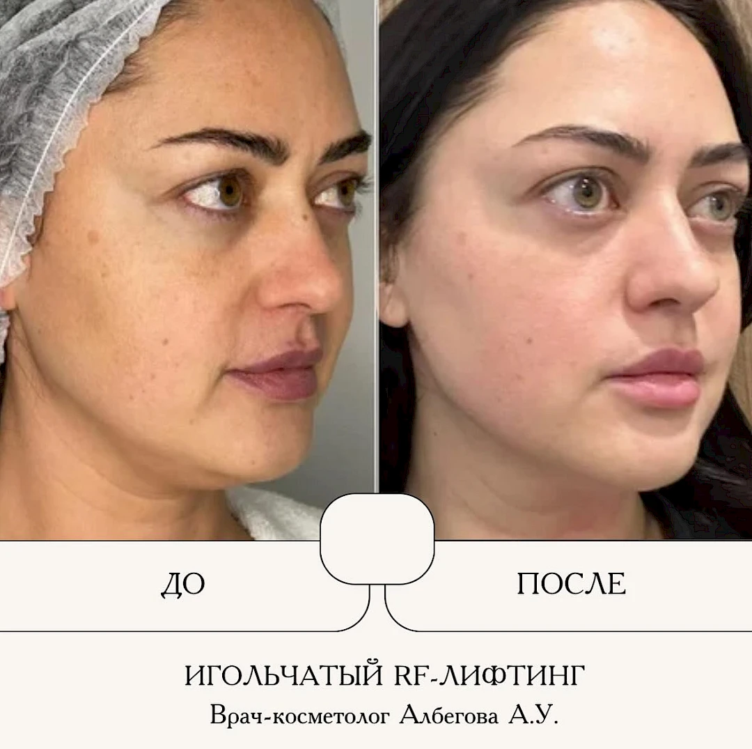Результат процедуры, кадр 8