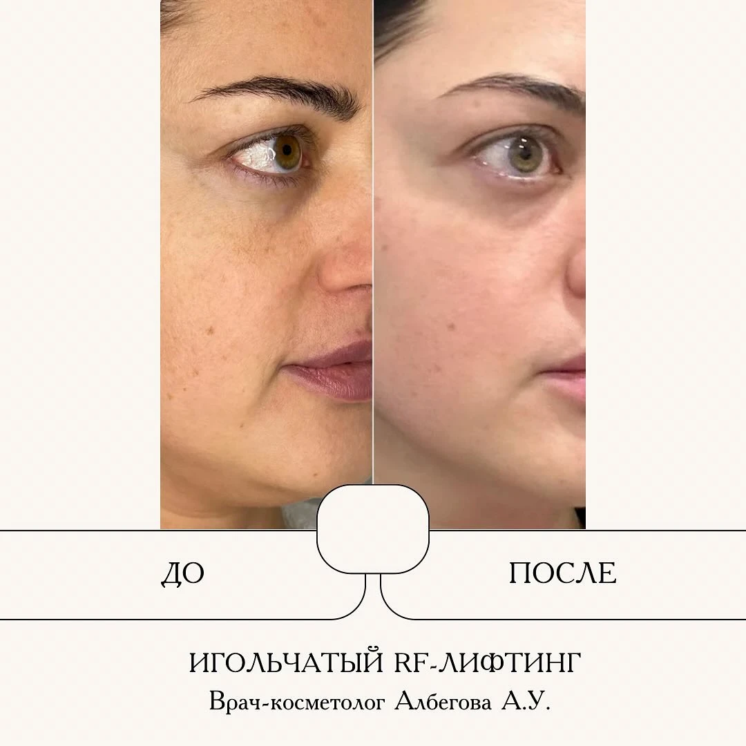 Результат процедуры, кадр 9